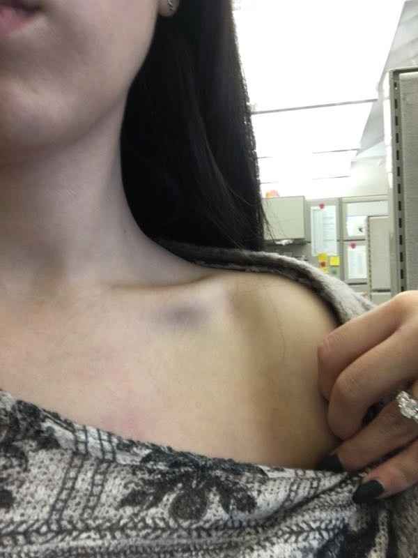 How to rid of shoulder marks so I can actually be excited to wear