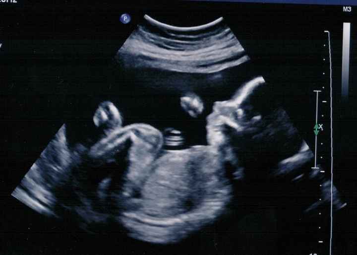 It's a....
