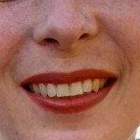 My pierced ears with earrings in every hole.