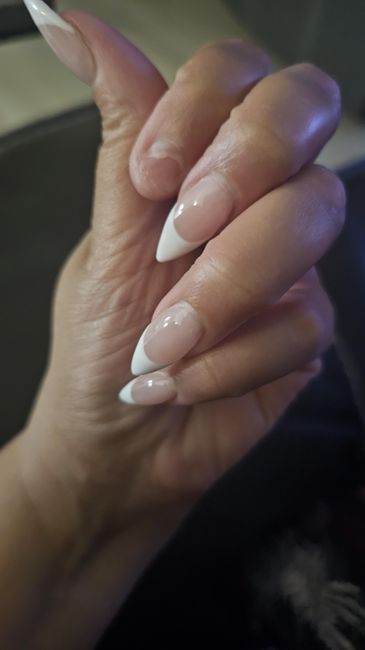My Finger Nail Fell Off 1 Month Before my Wedding!!! - 5
