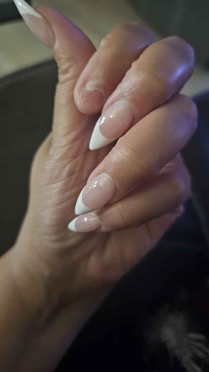 My Finger Nail Fell Off 1 Month Before my Wedding!!! - 5