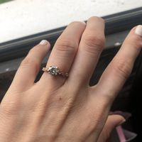 i got my ring and my finger is swollen. Help!!! - 1