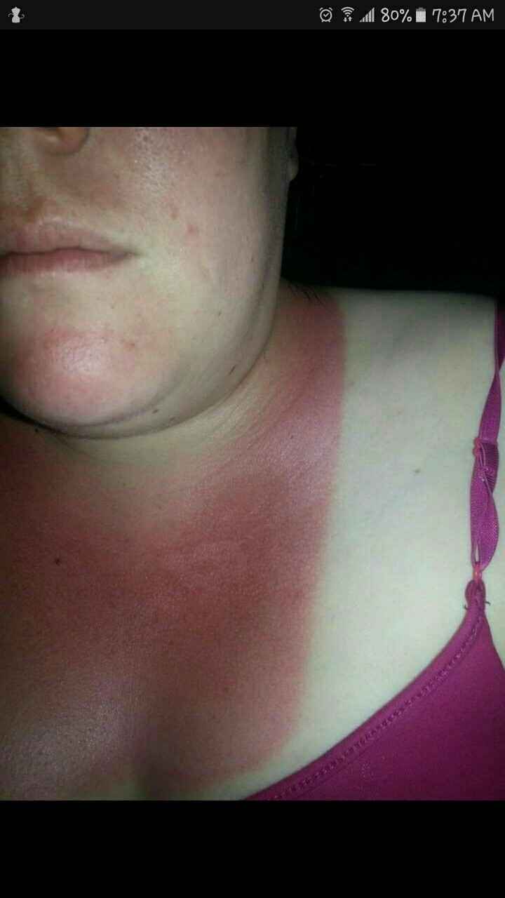 Help tan lines!!!