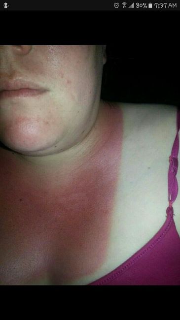 Help tan lines!!!