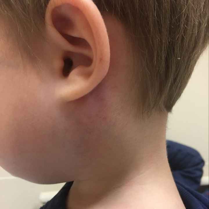 Update on my son- NWR