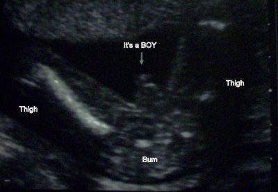 Weekly baby update time!!