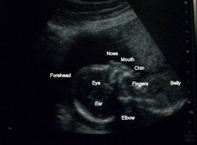 Weekly baby update time!!