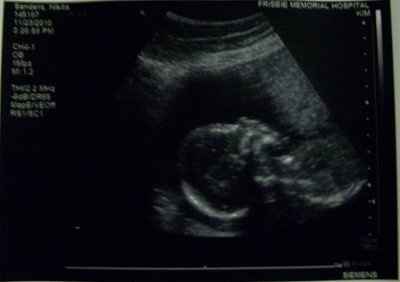 No I am NOT pregnant :)