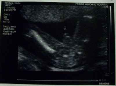 No I am NOT pregnant :)