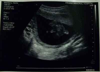 No I am NOT pregnant :)