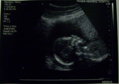No I am NOT pregnant :)