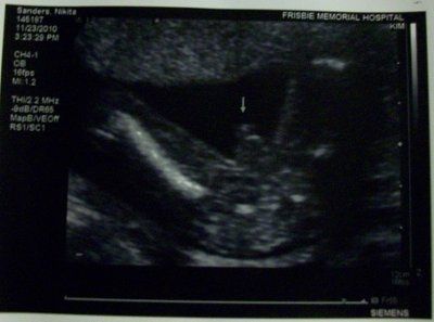 No I am NOT pregnant :)
