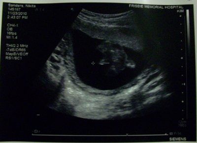 No I am NOT pregnant :)