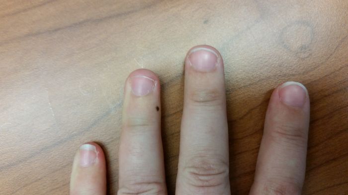 Nails!