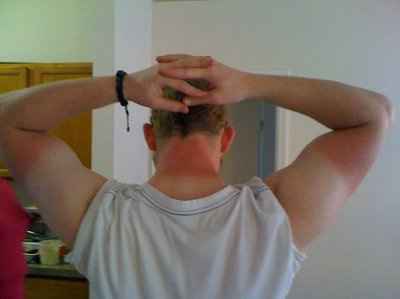 what to do about my hot piece of man chicken and his paleness??