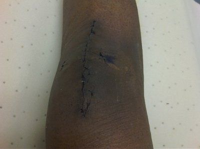 :( surgery while wedding planning