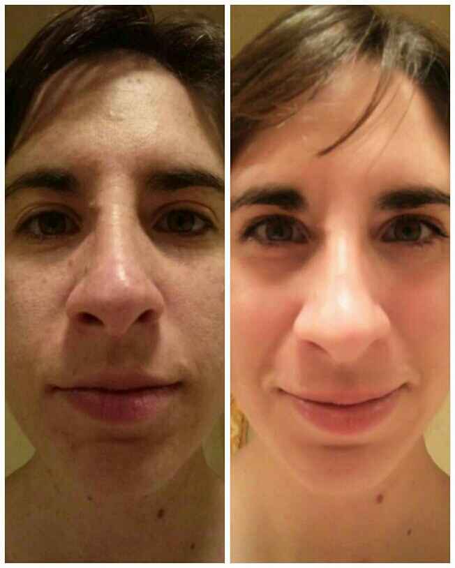 Skincare regimen? - 1