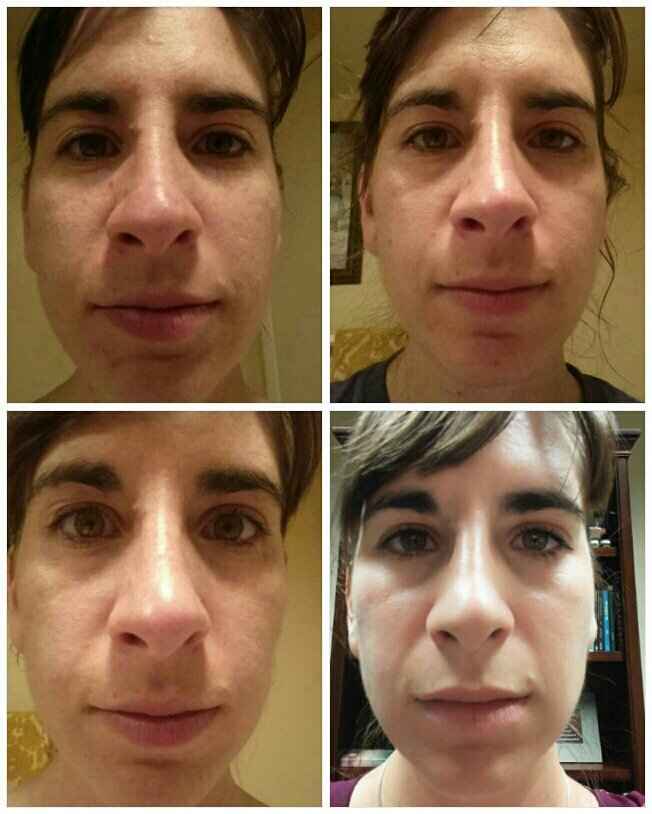 Skincare regimen? - 2