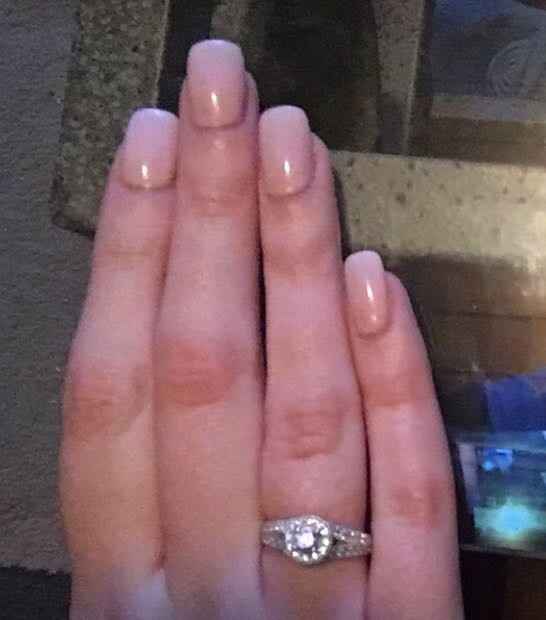 Nails and Toenails