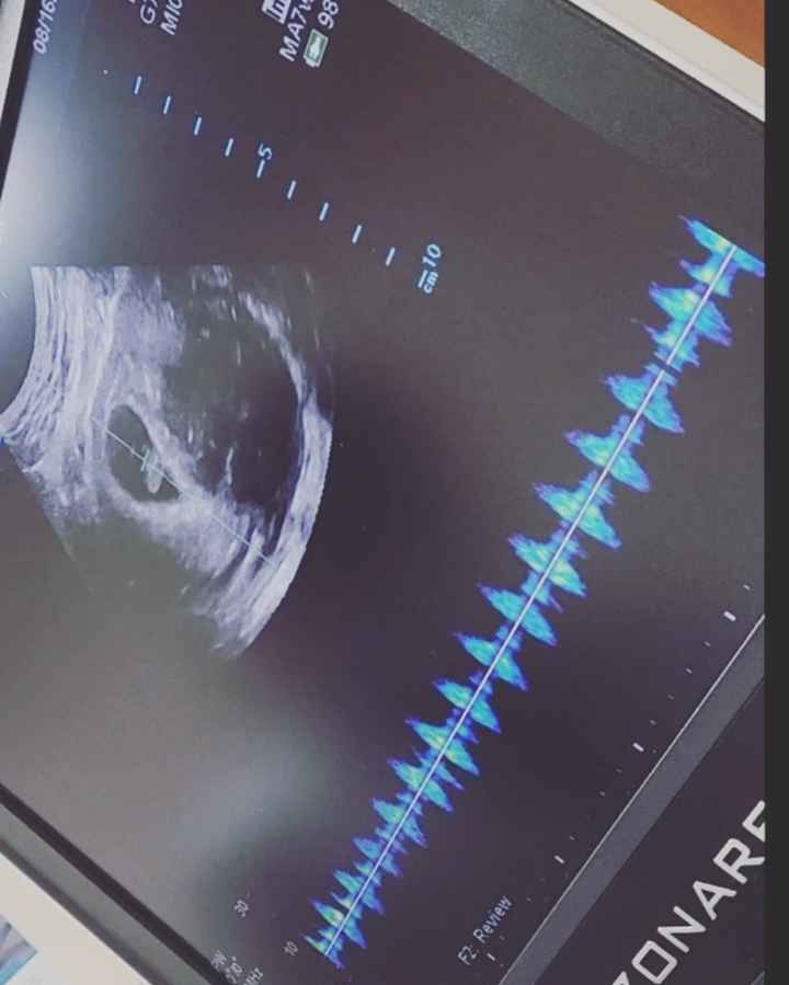 party of 3 in Spring 2023🤰🏿👫🏿💕 (we’re Expecting!!!!) - 2