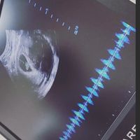 party of 3 in Spring 2023🤰🏿👫🏿💕 (we’re Expecting!!!!) - 2