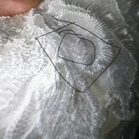 Loose dress threads on boob area - 2