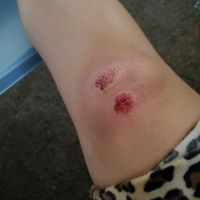 Bad week - 2