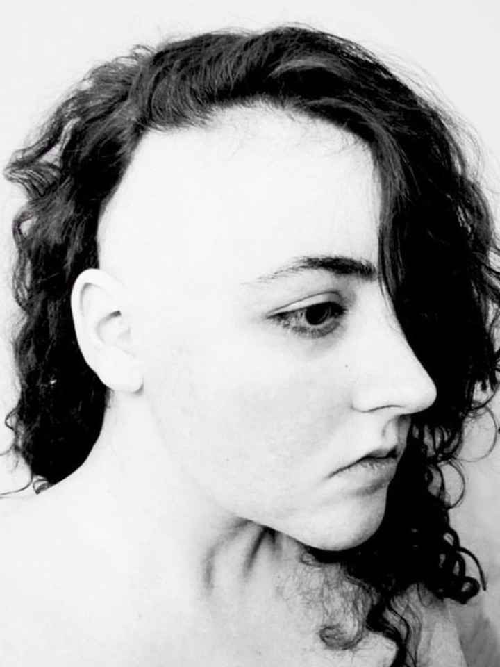 My hair is all flipped to one side in this photo, but it shows my hairline. It's at the same height 