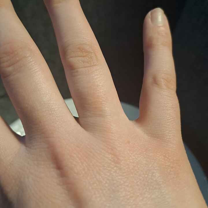 Do you think my ring is to small? - 2