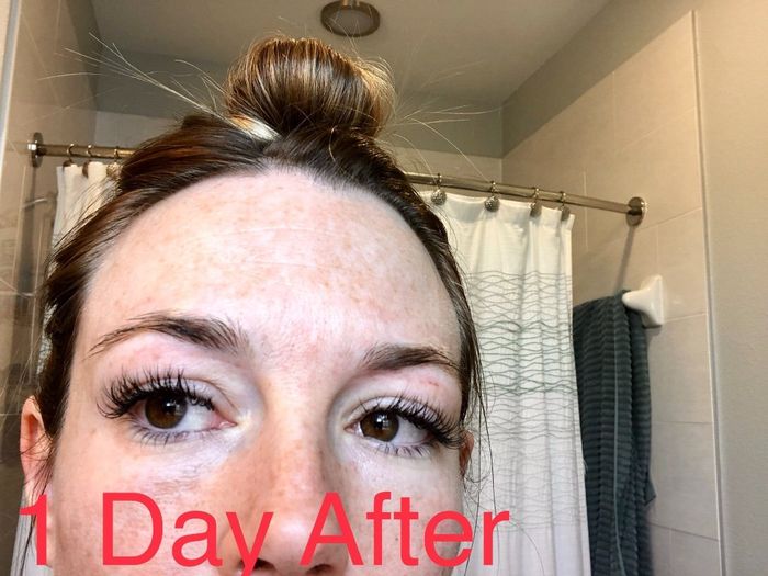 Help! Eyebrow wax burns and wedding is in 4 days! 1