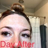 1 day after
