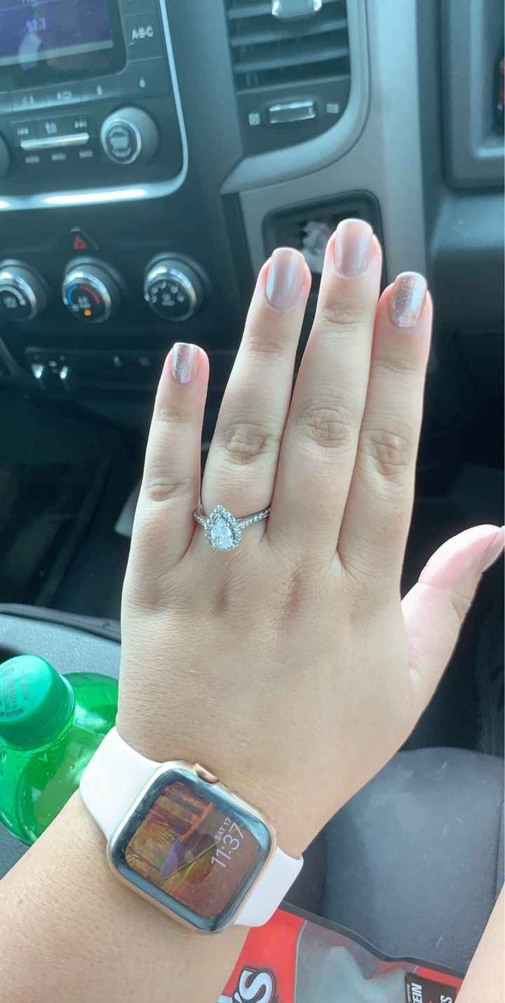 Wearing a ring 24/7? - 1
