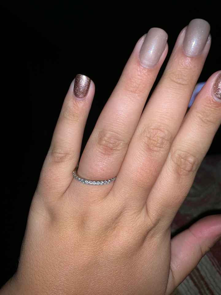 Wearing a ring 24/7? - 2