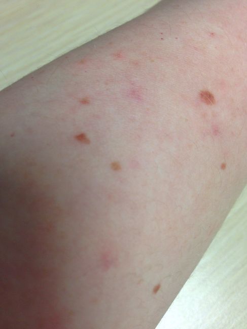 KWR: has anyone else had these weird arm bumps?
