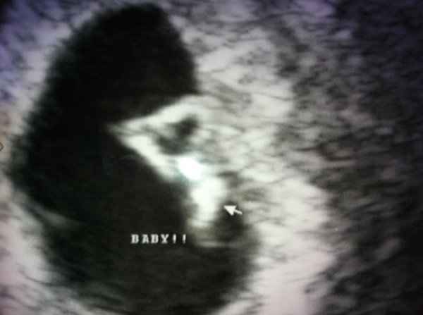 Its official FH and I are Pregnant!! :D