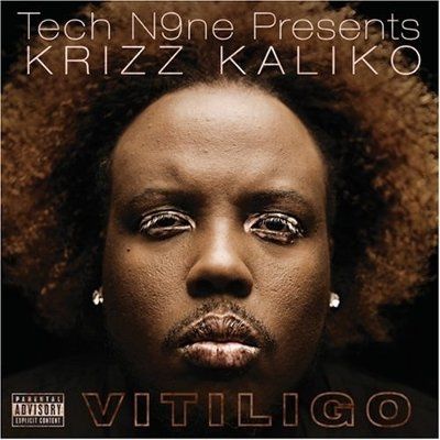 MUA Advice on Vitiligo