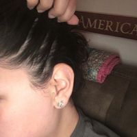 NWR: Hair thinning and PCOS UPDATE