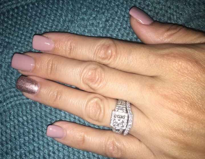 Wedding bands that don't sit flush