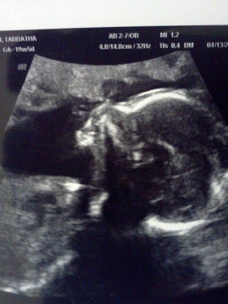 I haven't been on here in forever but just wanted to share that we found out what the baby is!