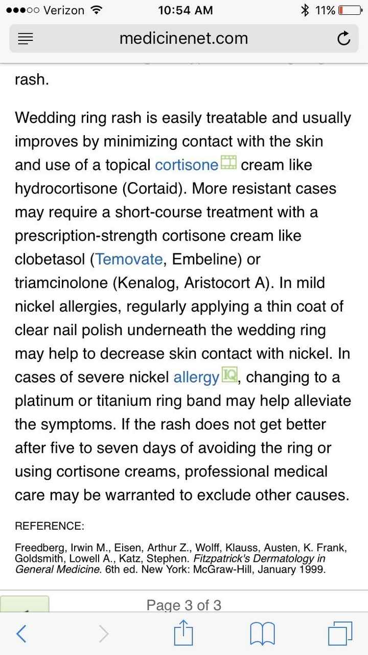 Lump under my engagement ring