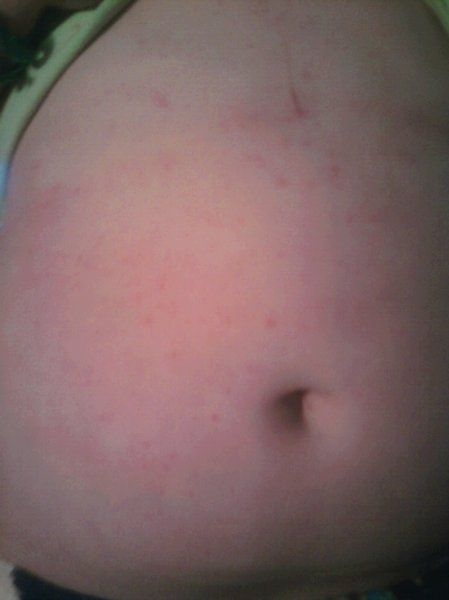 Please help!! - FH's little sister needs it :(