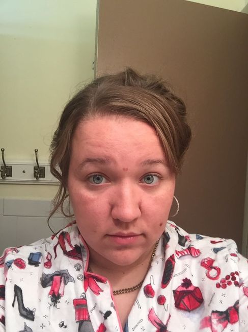 Hair trial