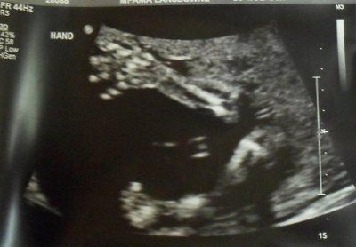 Babies, Babies, Babies...