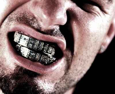 N E of u ALL got a messed up GRILL liek me?! (pix of me includeed)