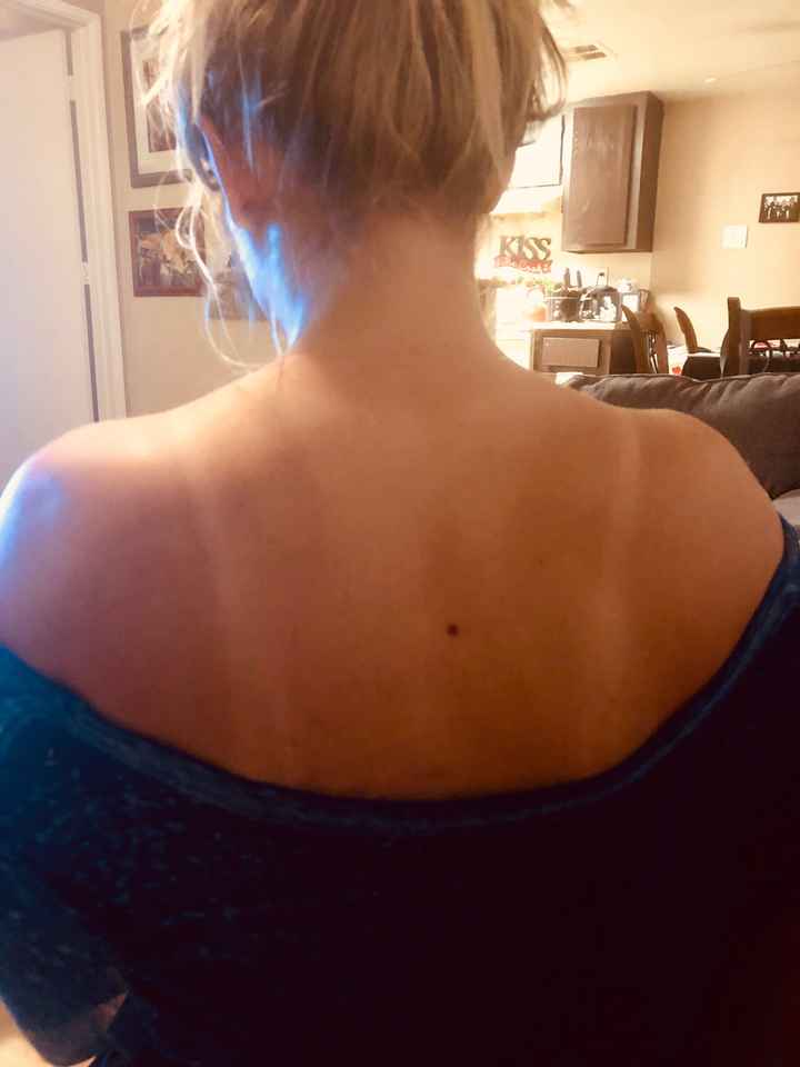 Help!! Tan lines a month before wedding!! - 1