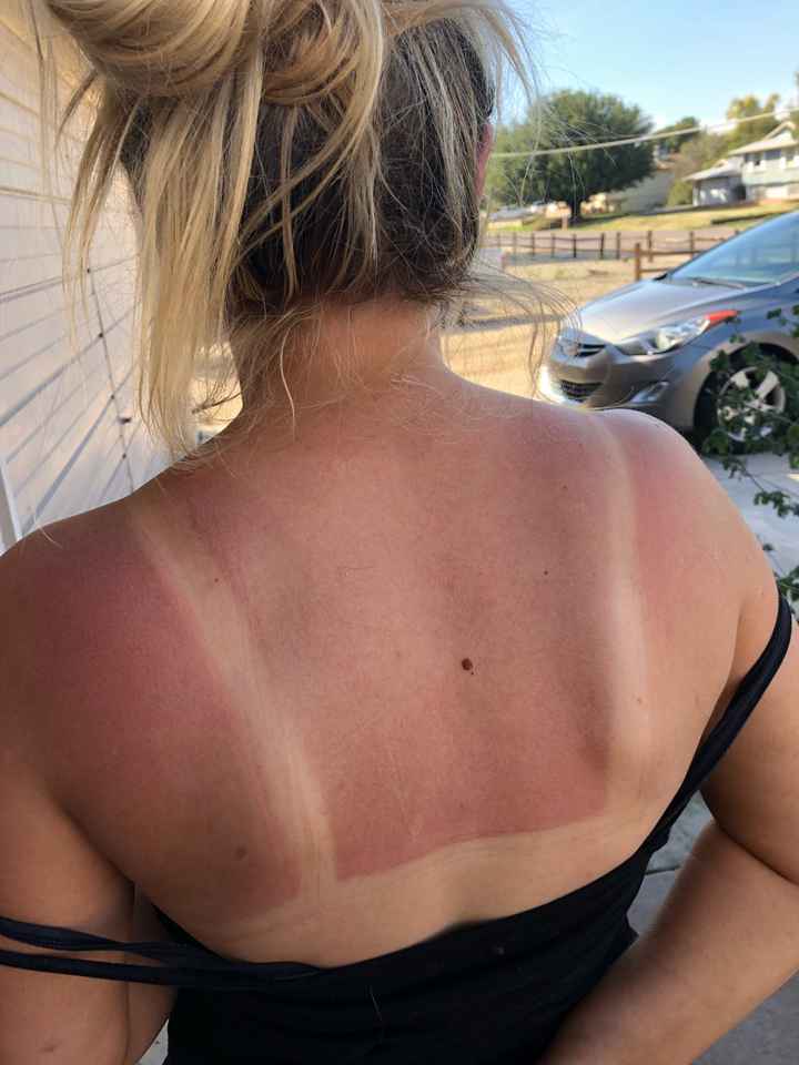 Help!! Tan lines a month before wedding!! - 1