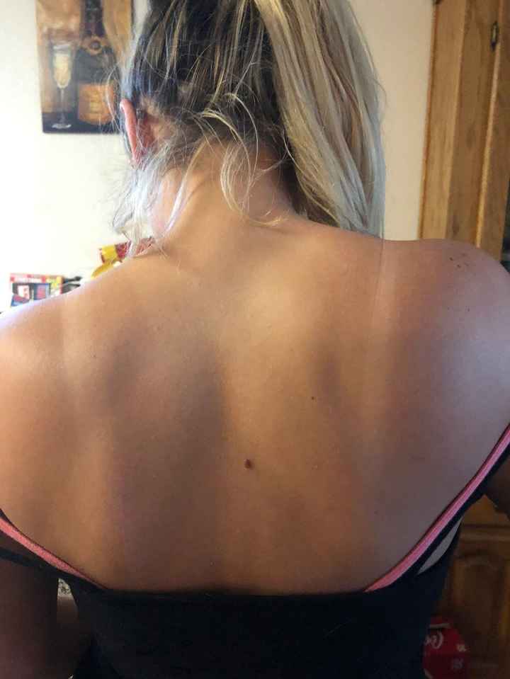 Tan lines