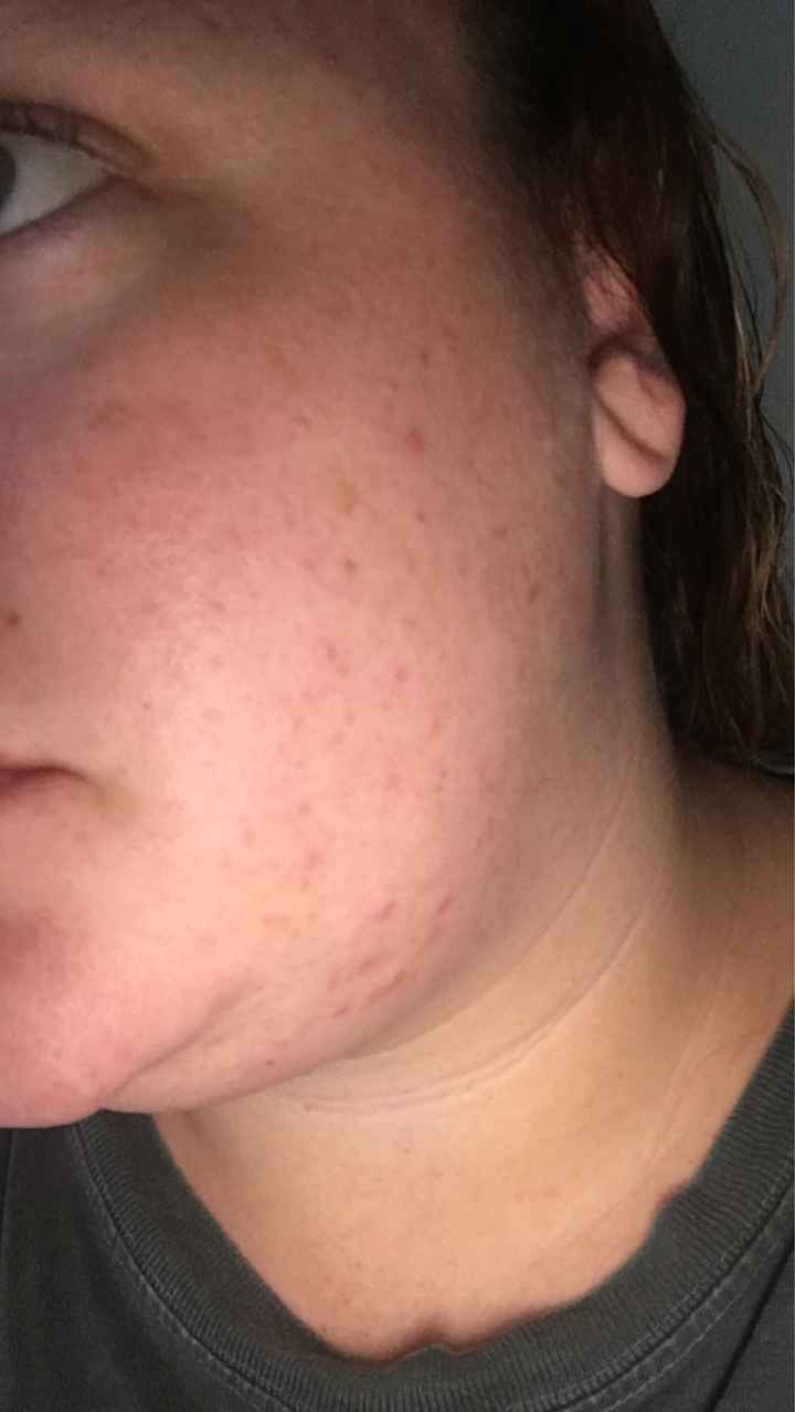 Skin Help Please! - 1