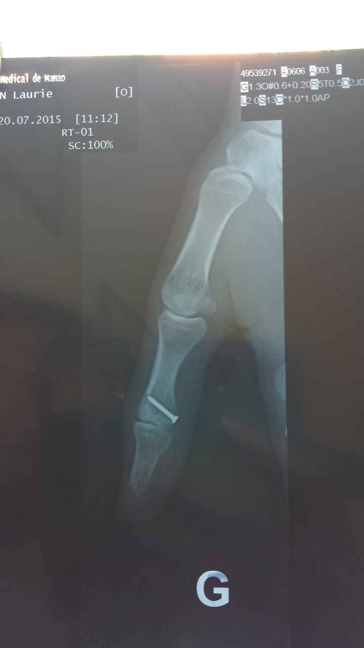 Injured on honeymoon, prayers please! ***UPDATE #2***