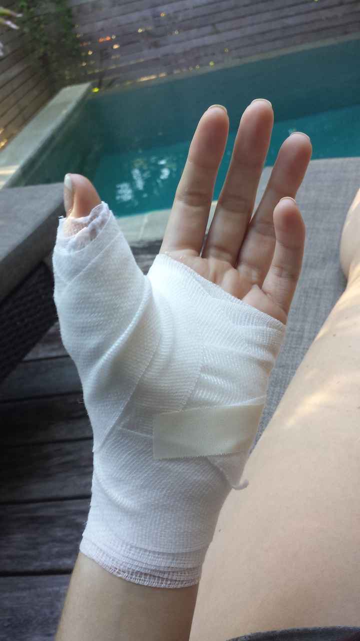 Injured on honeymoon, prayers please! ***UPDATE #2***